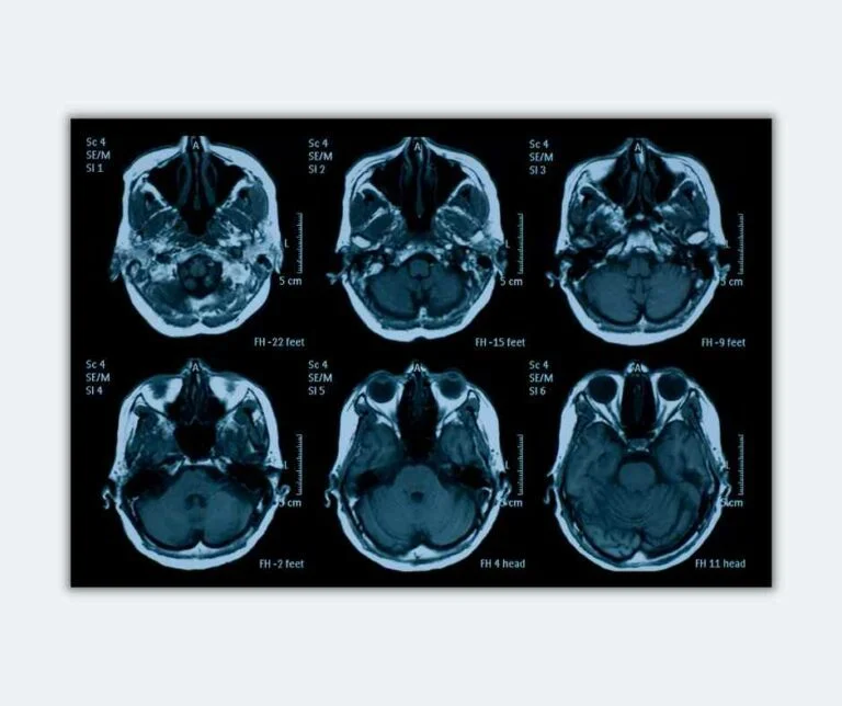 Pornography brain research